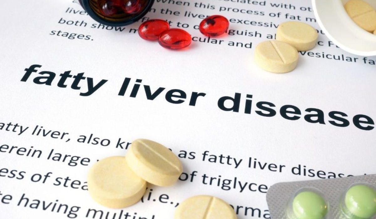 FATTY LIVER DISEASE