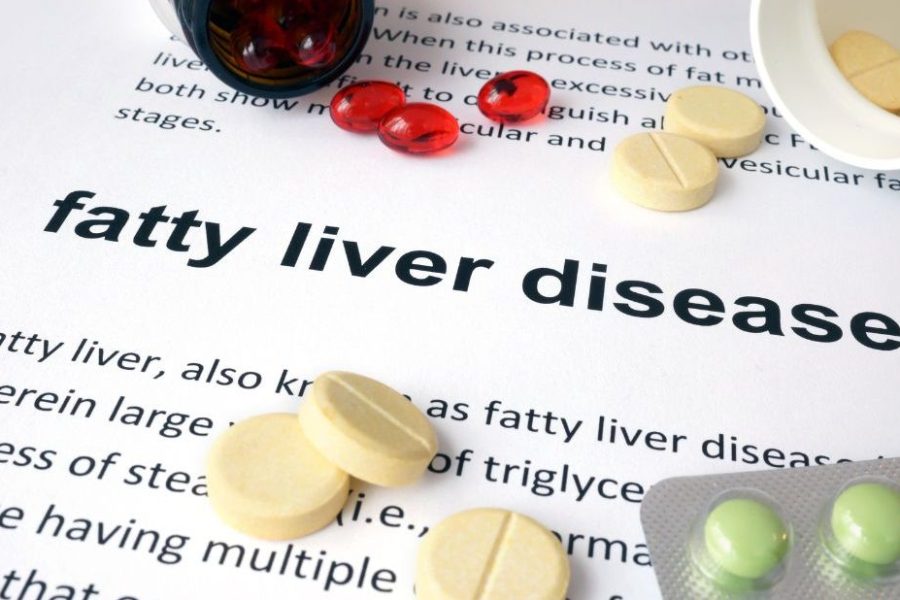 FATTY LIVER DISEASE