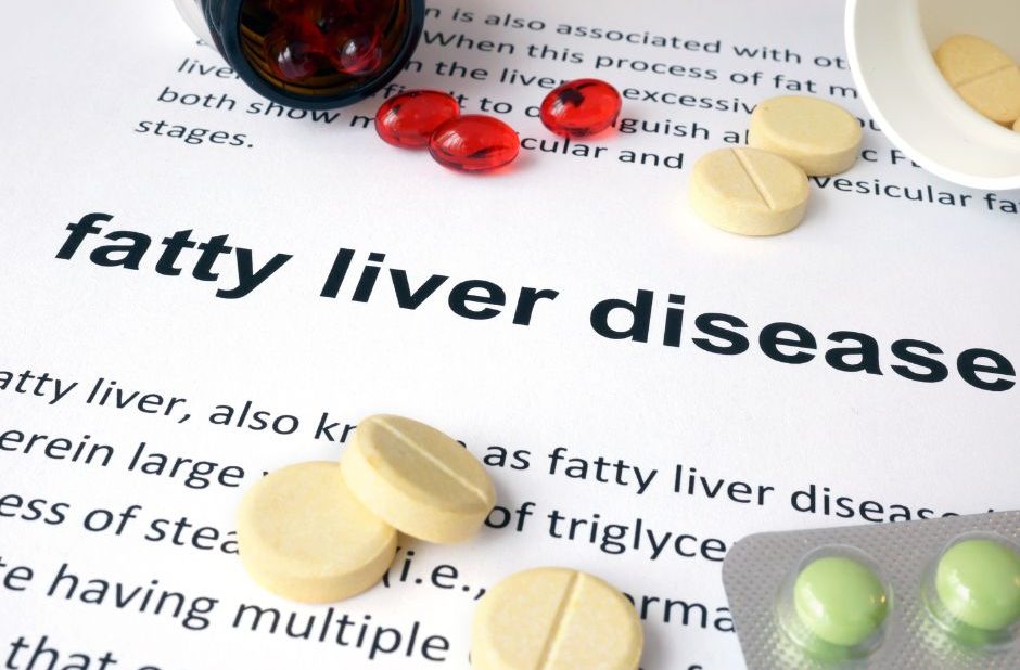 FATTY LIVER DISEASE