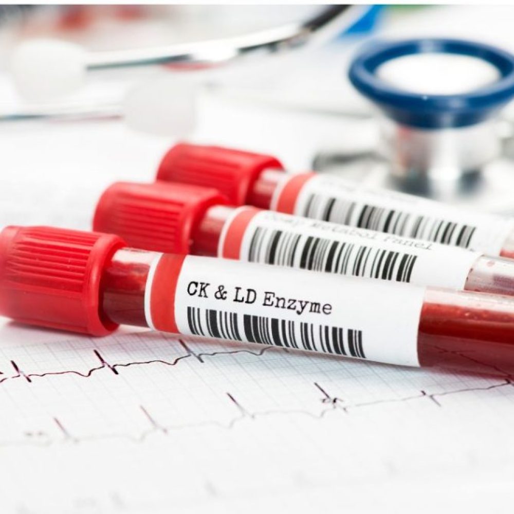 Comprehensive blood testing for optimal health